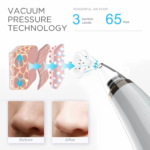 5-in-1 Blackhead Remover Pore Vacuum Cleaner Pimple Extractor - Facial Pore Cleaner Pore Extractor, USB Rechargeable Blackhead Remover Vacuum with 5 Probes - Image 6
