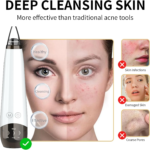 5-in-1 Blackhead Remover Pore Vacuum Cleaner Pimple Extractor - Facial Pore Cleaner Pore Extractor, USB Rechargeable Blackhead Remover Vacuum with 5 Probes - Image 7