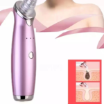 Electric Blackhead Remover Pore Vacuum Suction Acne Pimple Removal Vacuum Suction Tool Face Clean Skin Care - Image 6
